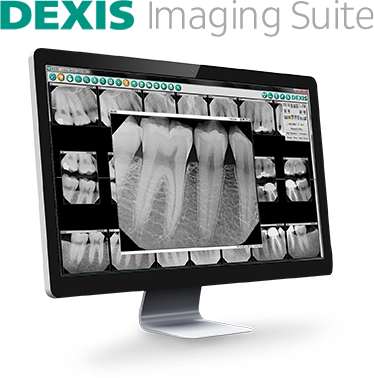 Digitial Radiography, Digital X-Rays